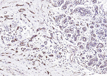 Angiopoietin-1 Rabbit Polyclonal Antibody