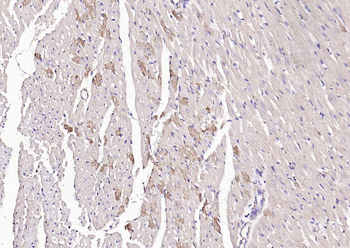 Angiopoietin-1 Rabbit Polyclonal Antibody