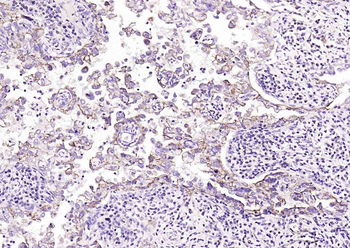 Adenosine deaminase Rabbit Polyclonal Antibody