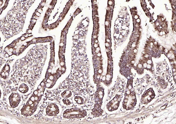 Adenosine deaminase Rabbit Polyclonal Antibody