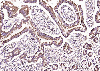 Adenosine deaminase Rabbit Polyclonal Antibody