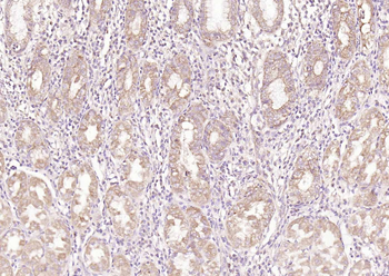 Adenosine deaminase Rabbit Polyclonal Antibody