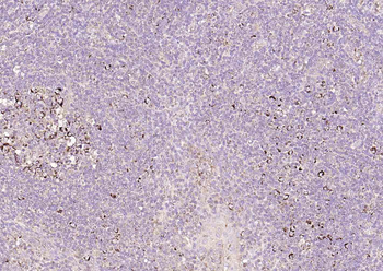 Adenosine deaminase Rabbit Polyclonal Antibody