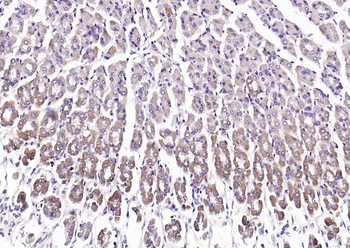 Adenosine deaminase Rabbit Polyclonal Antibody