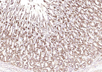 Adenosine deaminase Rabbit Polyclonal Antibody