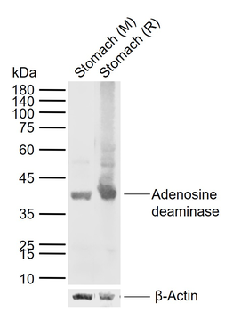 Adenosine deaminase Rabbit Polyclonal Antibody