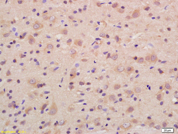 SCN11A Rabbit Polyclonal Antibody