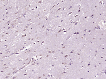 SERBP1 Rabbit Polyclonal Antibody