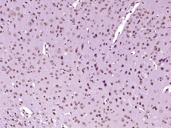 SERBP1 Rabbit Polyclonal Antibody