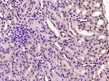 SERBP1 Rabbit Polyclonal Antibody