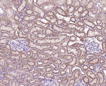 Phospho-PLB (Ser16) Rabbit Polyclonal Antibody