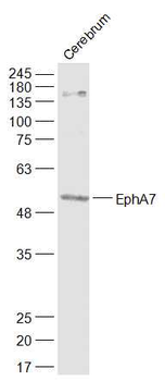 EphA7 Rabbit Polyclonal Antibody