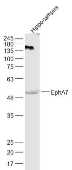 EphA7 Rabbit Polyclonal Antibody
