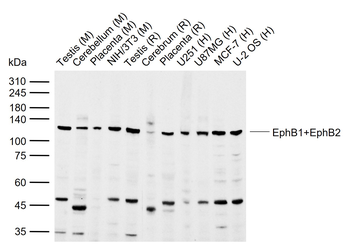 EphB1+EphB2 Rabbit Polyclonal Antibody