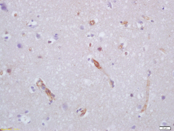 VEGFA Rabbit Polyclonal Antibody