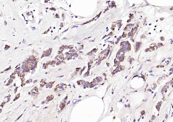 ALOX15B Rabbit Polyclonal Antibody