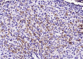 ALOX15B Rabbit Polyclonal Antibody