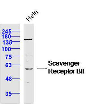 Scavenger Receptor BII Rabbit Polyclonal Antibody