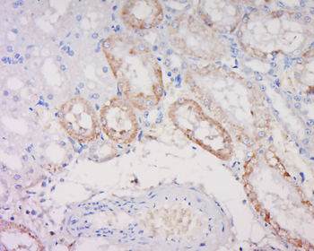 Noggin Rabbit Polyclonal Antibody