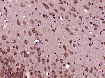 Phospho-EPH A3+A4+A5 (Tyr779) Rabbit Polyclonal Antibody