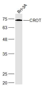 CROT Rabbit Polyclonal Antibody