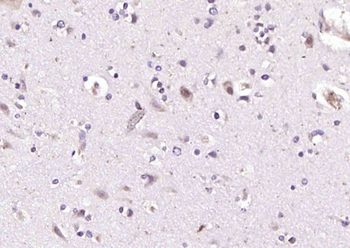 RANBP9 Rabbit Polyclonal Antibody