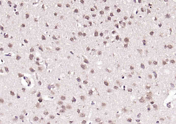 RANBP9 Rabbit Polyclonal Antibody
