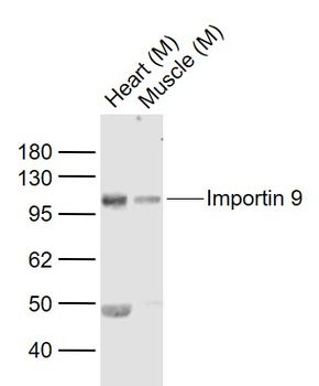 RANBP9 Rabbit Polyclonal Antibody
