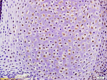 STAMBP Rabbit Polyclonal Antibody