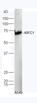 KIFC1 Rabbit Polyclonal Antibody
