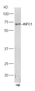 KIFC1 Rabbit Polyclonal Antibody