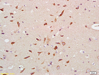 BRSK1 Rabbit Polyclonal Antibody