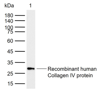 Collagen IV Rabbit Polyclonal Antibody