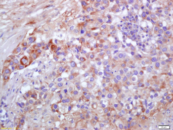 Collagen IV Rabbit Polyclonal Antibody