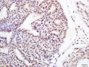 HnRNP F Rabbit Polyclonal Antibody