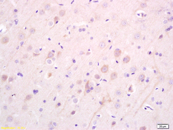 EBF3 Rabbit Polyclonal Antibody