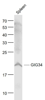GIG34 Rabbit Polyclonal Antibody