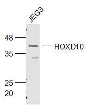 HOXD10 Rabbit Polyclonal Antibody