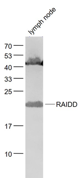 RAIDD Rabbit Polyclonal Antibody