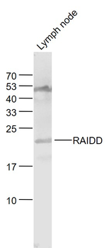 RAIDD Rabbit Polyclonal Antibody