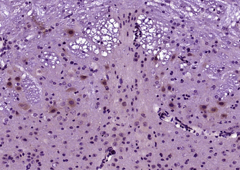 Klotho Rabbit Polyclonal Antibody