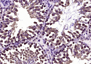 Klotho Rabbit Polyclonal Antibody