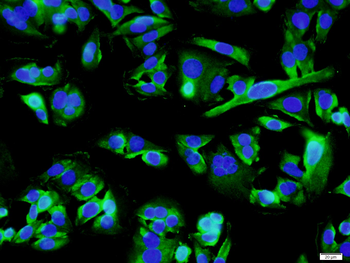 Gamma-Adaptin Rabbit Polyclonal Antibody