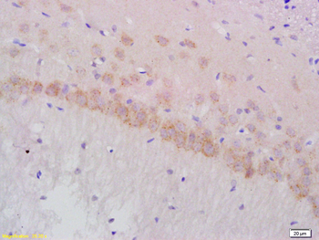 Gamma-Adaptin Rabbit Polyclonal Antibody