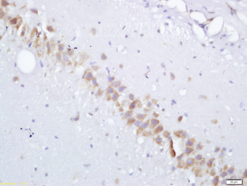 Gamma-Adaptin Rabbit Polyclonal Antibody