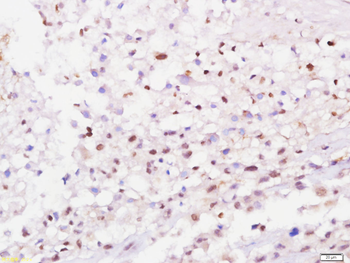 WAVE 1 Rabbit Polyclonal Antibody