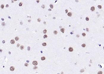 KLHL7 Rabbit Polyclonal Antibody