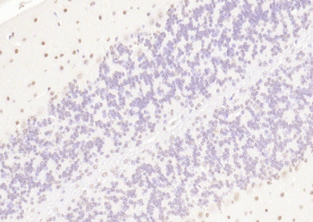 KLHL7 Rabbit Polyclonal Antibody