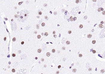 KLHL7 Rabbit Polyclonal Antibody