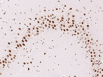 KLHL7 Rabbit Polyclonal Antibody